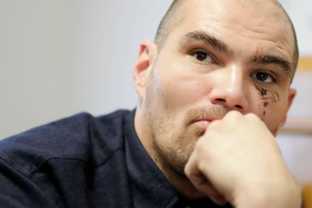 Randy Tharp is recovering from a fentanyl addiction at a clean-and-sober home in Lynnwood. (Kevin Clark / The Herald)