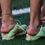 A runner pulls off their spiked shoes to relieve blisters on the back of their heels at the Hole In The Wall Invitational on Saturday, Oct. 8, 2022 in Arlington, Washington. (Olivia Vanni / The Herald)