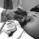 Rogelio V. Solis / Associated Press file photo
A doctor uses a hand-held Doppler probe on a pregnant woman to measure the heartbeat of the fetus in December, 2021, in Jackson, Miss.