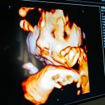 A live rendering of Franchesca and Don Simpsons child is displayed on a large screen while Kelly Fox does an ultrasound at Wonder Baby Ultrasound Studio in Everett. Fox, the owner of Wonder Baby, is able to collect still images during the live 4D ultrasounds which she can then share with expectant couples. (Ryan Berry / The Herald)