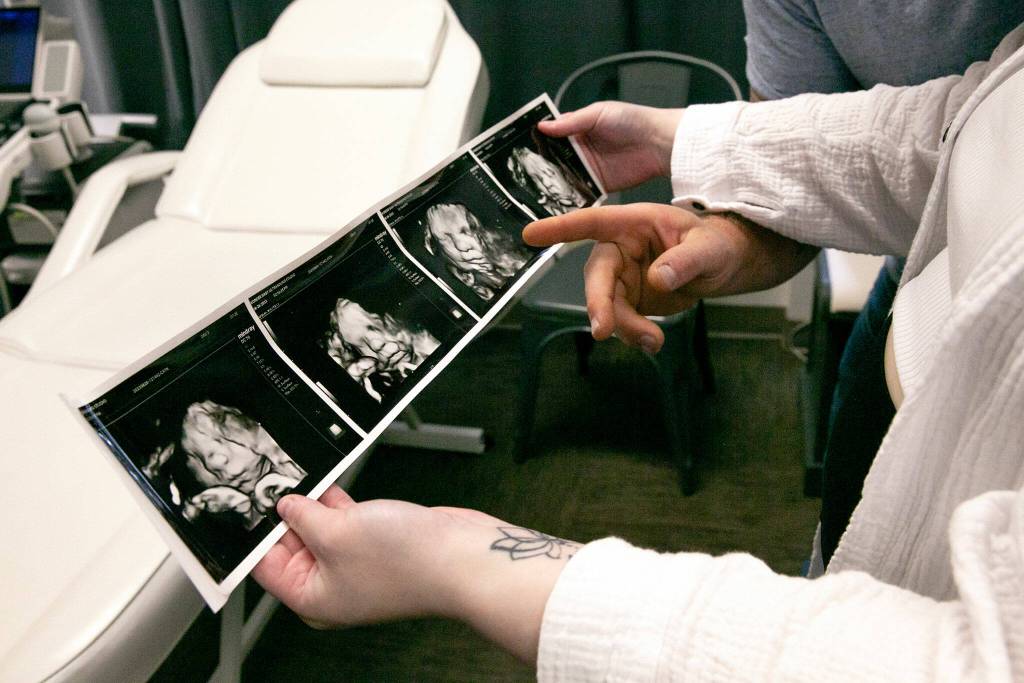 A roll of four photos is printed out of Franchesca and Don Simpsons baby girl after an ultrasound session at Wonder Baby Ultrasound Studio. (Ryan Berry / The Herald)