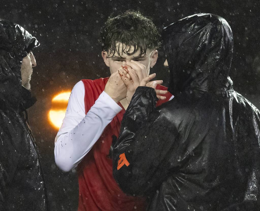 Blood is visible on the fingers of Snohomishs Colton Moores uses his hands to stop his nose from bleeding after colliding with a teammate while trying to head the ball during the game against Snohomish on Wednesday, March 12, 2025 in Snohomish, Washington. (Olivia Vanni / The Herald)